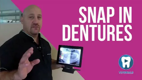 Are snap-in dentures covered by insurance